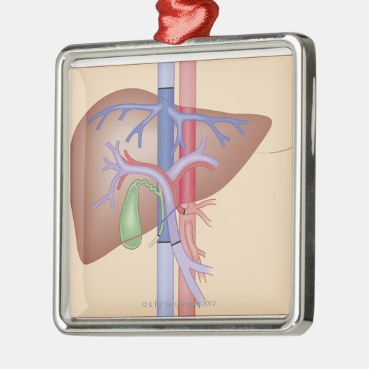 Leber-Transplantations-Verfahren Silbernes Ornament (Links)