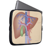 Lebertransplantation Laptopschutzhülle (Vorne Rechts)