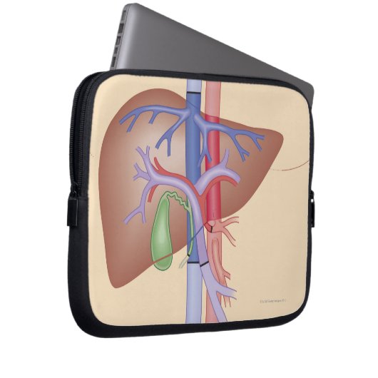 Lebertransplantation Laptopschutzhülle (Vorne Rechts)