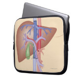 Lebertransplantation Laptopschutzhülle (Vorderseite Links)