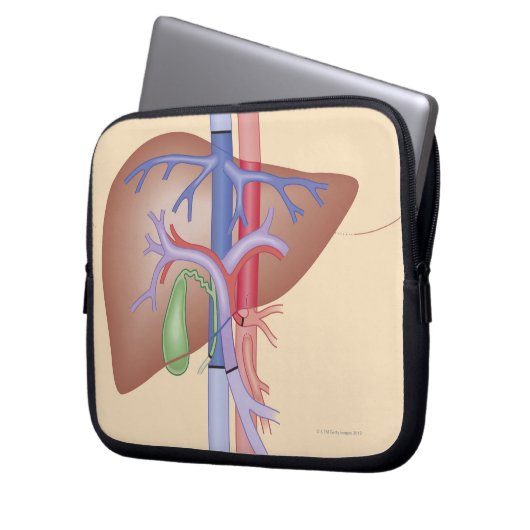 Lebertransplantation Laptopschutzhülle (Vorderseite Links)