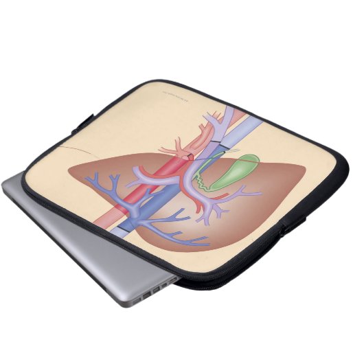Lebertransplantation Laptopschutzhülle (Vorne Knopf)