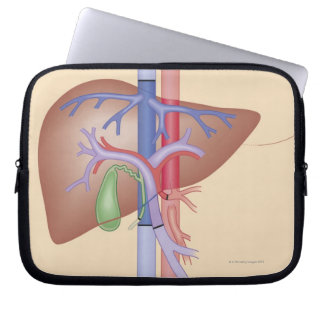 Lebertransplantation Laptopschutzhülle