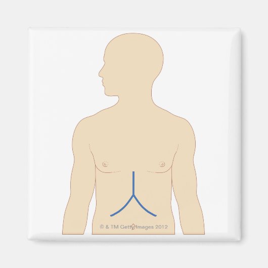 Lebertransplantation Magnet (Vorne)