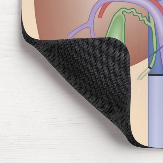 Lebertransplantation Mousepad (Ecke)