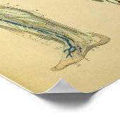 Leg Lymphatics Veins Anatomie Vinatge Art Print Poster (Ecke)