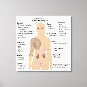 Leinwanddruck Diagramm Zeichen Symptome Fibromyalg