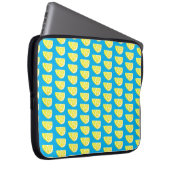 Lemon Slice Musterelektronik-Bag Laptopschutzhülle (Vorne Rechts)