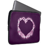 Liebe Ballet Laptopschutzhülle (Vorne Rechts)