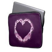 Liebe Ballet Laptopschutzhülle (Vorderseite Links)