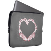 Liebe Ballet Laptopschutzhülle (Vorne Rechts)