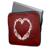 Liebe Ballet Laptopschutzhülle (Vorderseite Links)