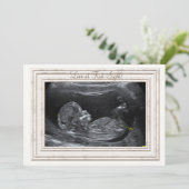 Liebe bei Ankündigung der Schwangerschaft am erste (Stehend Vorderseite)