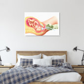 Lieferung von Fetus mithilfe der Vakuumextrahierun Leinwanddruck (Insitu (Schlafzimmer))
