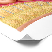 Lieferung von Fetus mithilfe der Vakuumextrahierun Poster (Ecke)