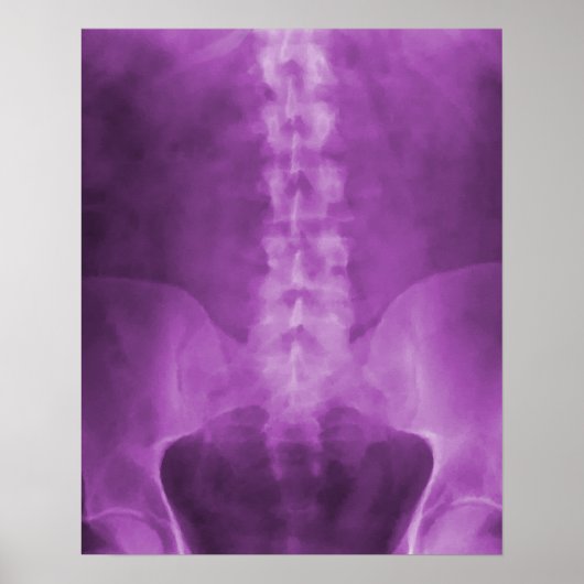 Lila digitale Röntgenkunst Poster (Vorne)