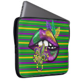 LILA GRÜNE GOLD STRIPEN UND LUSH LIPS LAPTOPSCHUTZHÜLLE (Vorne Rechts)