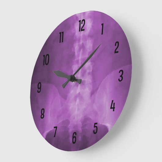 Lila Uhr für digitale Röntgenbilder (Winkel)