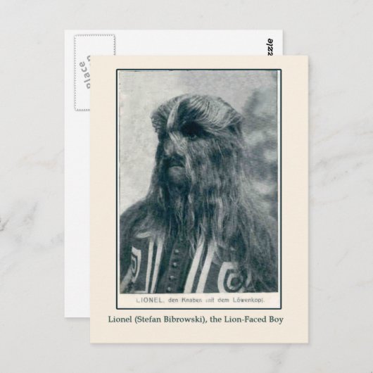 Lionel, die Lion Faced Boy Cards und Postkarten (Vorne/Hinten)