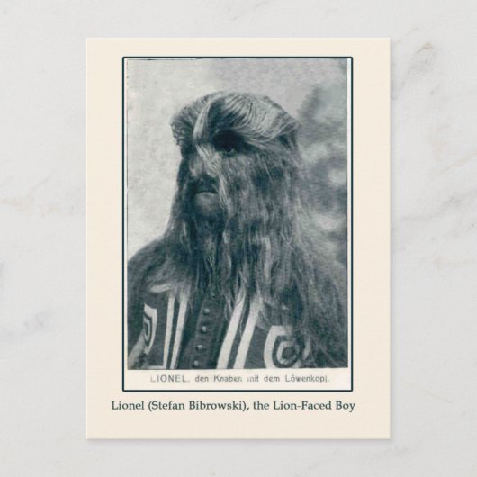 Lionel, die Lion Faced Boy Cards und Postkarten (Vorderseite)