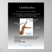 Lipogelöste Poster (Vorne)