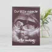 Little Miracle Ultrasound 2 Foto Baby Family Ankündigung (Stehend Vorderseite)