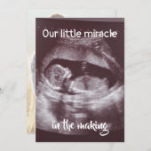 Little Miracle Ultrasound 2 Foto Baby Family Ankündigung (Vorne/Hinten)