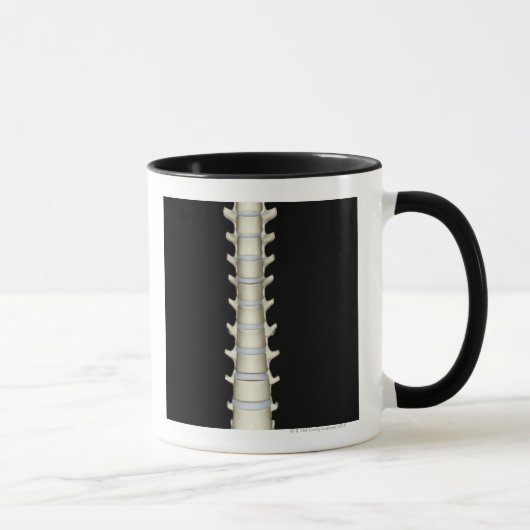 Lumbale und Brust- Wirbel Tasse (Rechts)