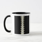 Lumbale und Brust- Wirbel Tasse (Links)