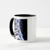 Lumbale Wirbel 2 Tasse (Vorderseite Links)