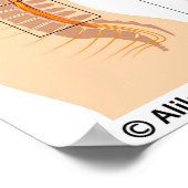 Lumbar epidurale Injektion, beschriftet. Poster (Ecke)