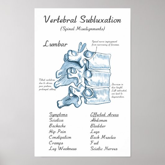 Lumbar Subluxation Chiropractic Art Poster (Vorne)