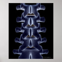 Lumbar Vertebra 2