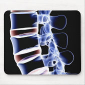 Lumbar Vertebrae 2 Mousepad (Vorne)