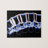 Lumbar Vertebrae 2 Puzzle (Horizontal)