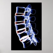 Lumbar Vertebrae Poster (Vorne)