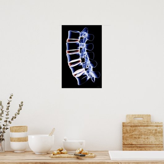 Lumbar Vertebrae Poster (Küche)