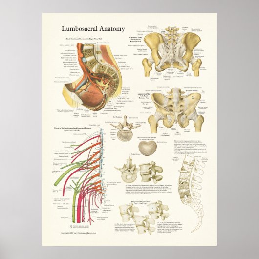 Lumbosacral Anatomie Poster und Spine Degeneration (Vorne)