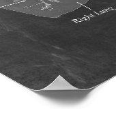 Lung Anatomy Trachea und Bronchi Poster (Ecke)