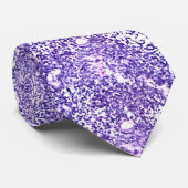 Lungen-kleines Zellen-Krebsgeschwür Krawatte (Gerollt)