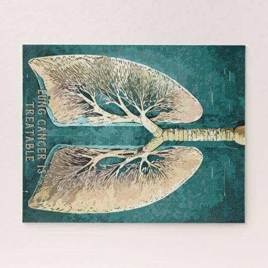 Lungen Puzzle (Horizontal)