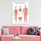 Lungenembolie, Embolusweg Leinwanddruck (Insitu (Wohnzimmer))