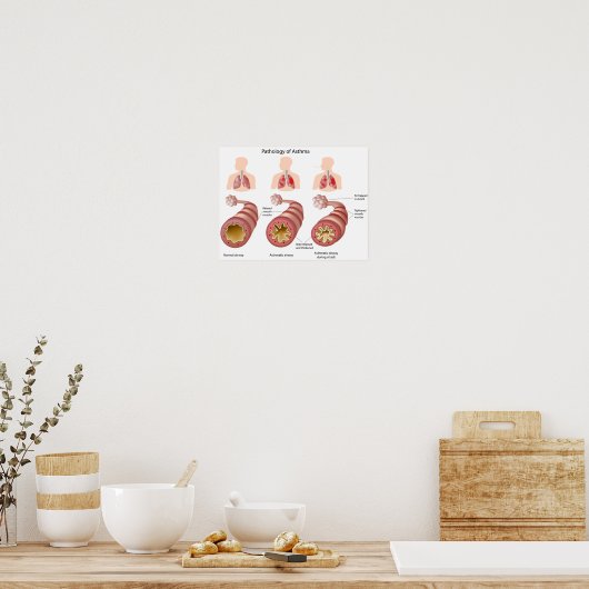 Lungenerkrankung Asthma Poster (Küche)