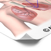 Lungenerkrankung COPD-etikettiertes Poster (Ecke)
