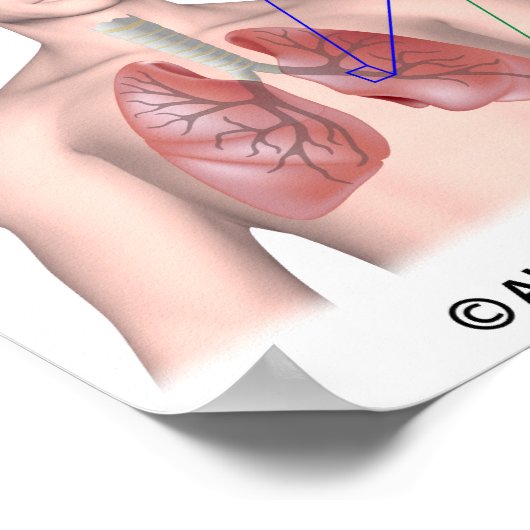 Lungenerkrankung COPD-etikettiertes Poster (Ecke)