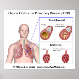 Lungenerkrankung COPD-etikettiertes Poster