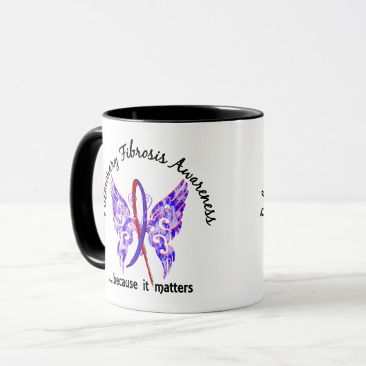 Lungenfibrose des Schmetterlings-6,1 Tasse (Vorderseite Links)
