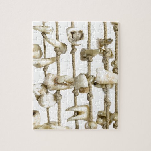 Lustige zahnmedizinische Fotografie extrahierter Puzzle (Vertikal)