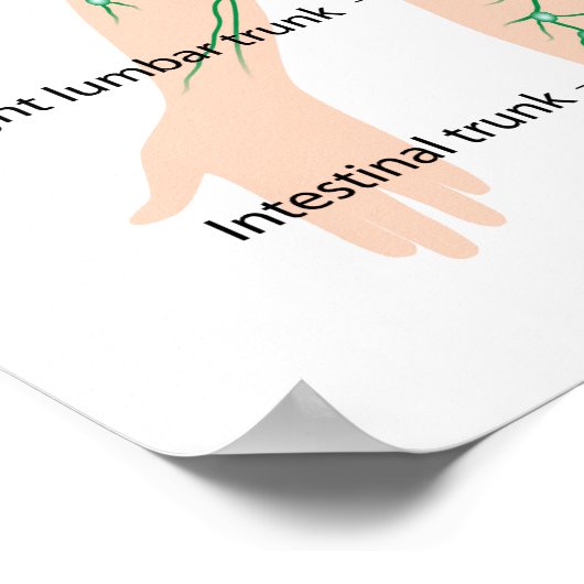 Lymphdrainage mit Plakat (Ecke)