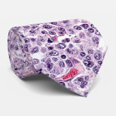 Lymphom Krawatte (Gerollt)